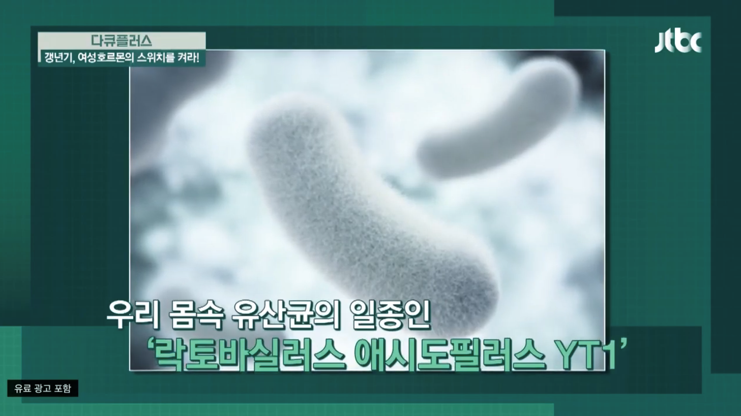  40대-50대 여성 갱년기 유산균 YT1 효능 알아보기