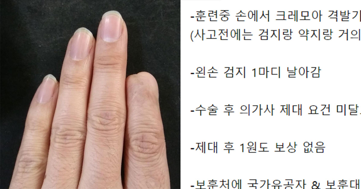  군대에서 사고로 손가락 한 마디 잘린 사람이 받는 대우