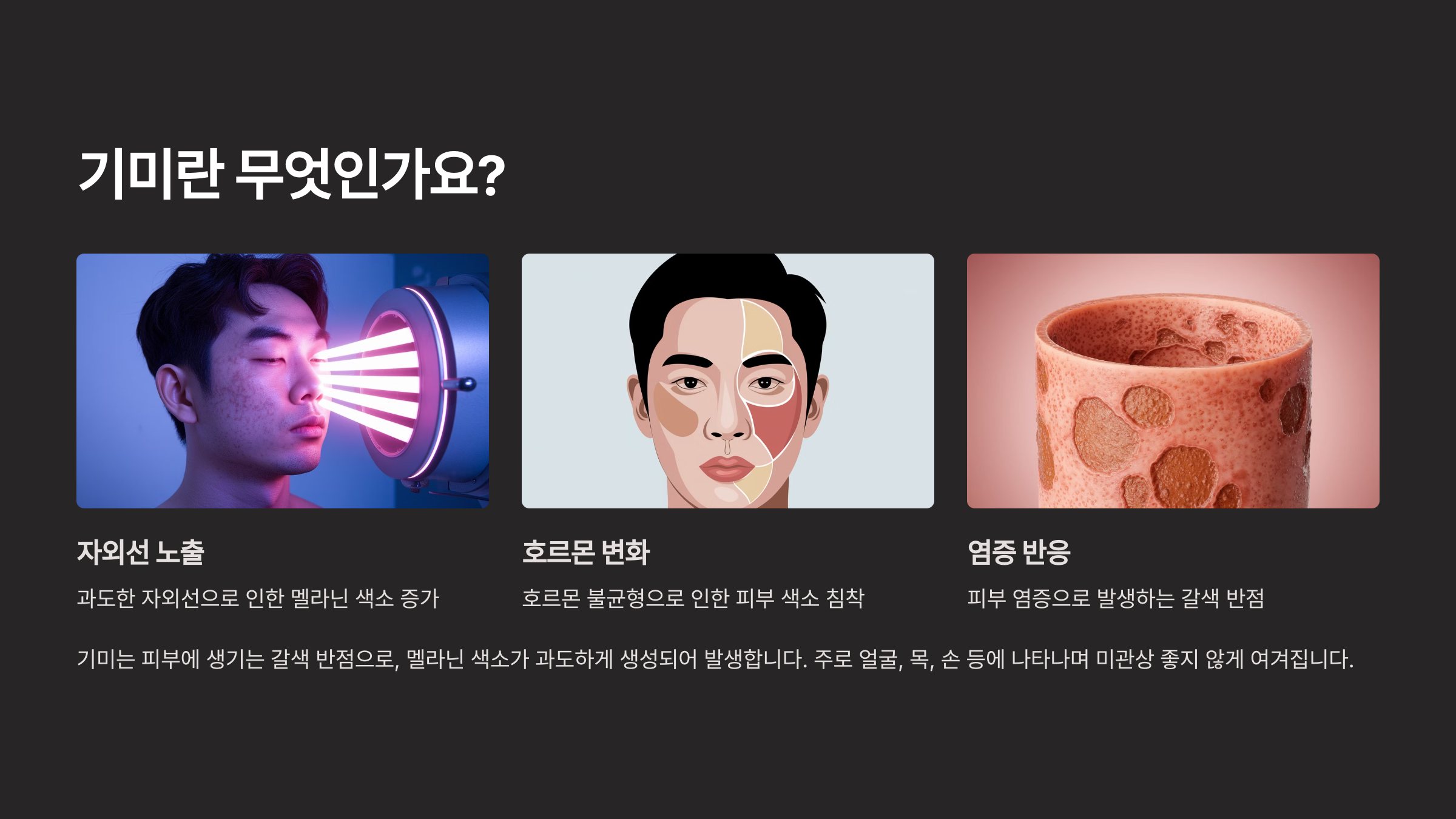 알아두면 돈 버는 기미 크림 선택 꿀팁 공개!
