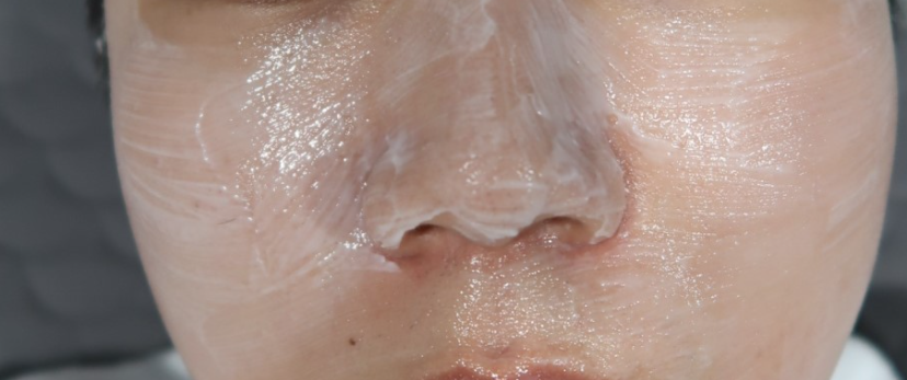 남성 피부과 비타민 케어, 백옥주사 효과, 가격 글루타티온에 대한 이야기 9