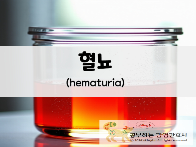 “혈뇨”(hematuria)이해하기: 즉시 병원 가야하는 경우 소변에 피가 섞여 나오는 증상.. 원인 및 치료