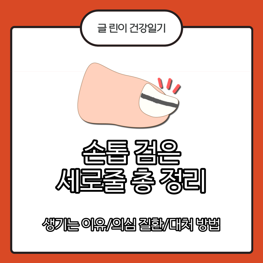  손톱 검은 세로줄 총 정리
