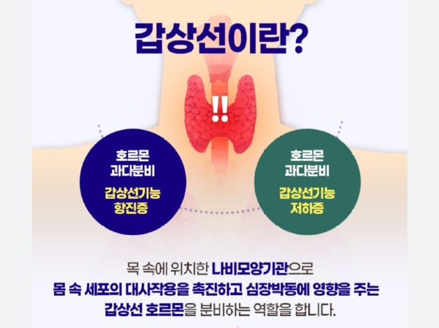 갑상선 저하증·항진증 차이