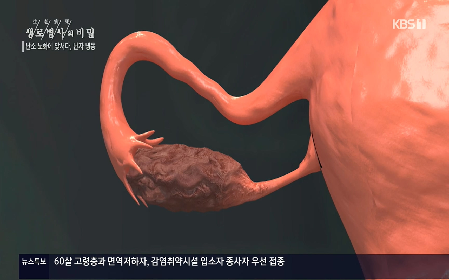 생로병사의 비밀.E836.220921p.H264-F1RST.mp4_20220925_183658.068.jpg