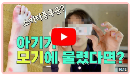아기가 모기에 물렸을때 올바른 대처방법