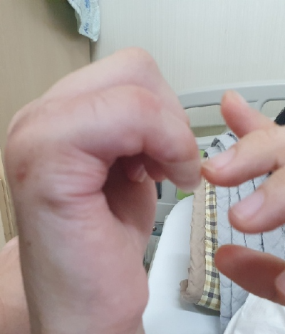 손가락 골절 재활