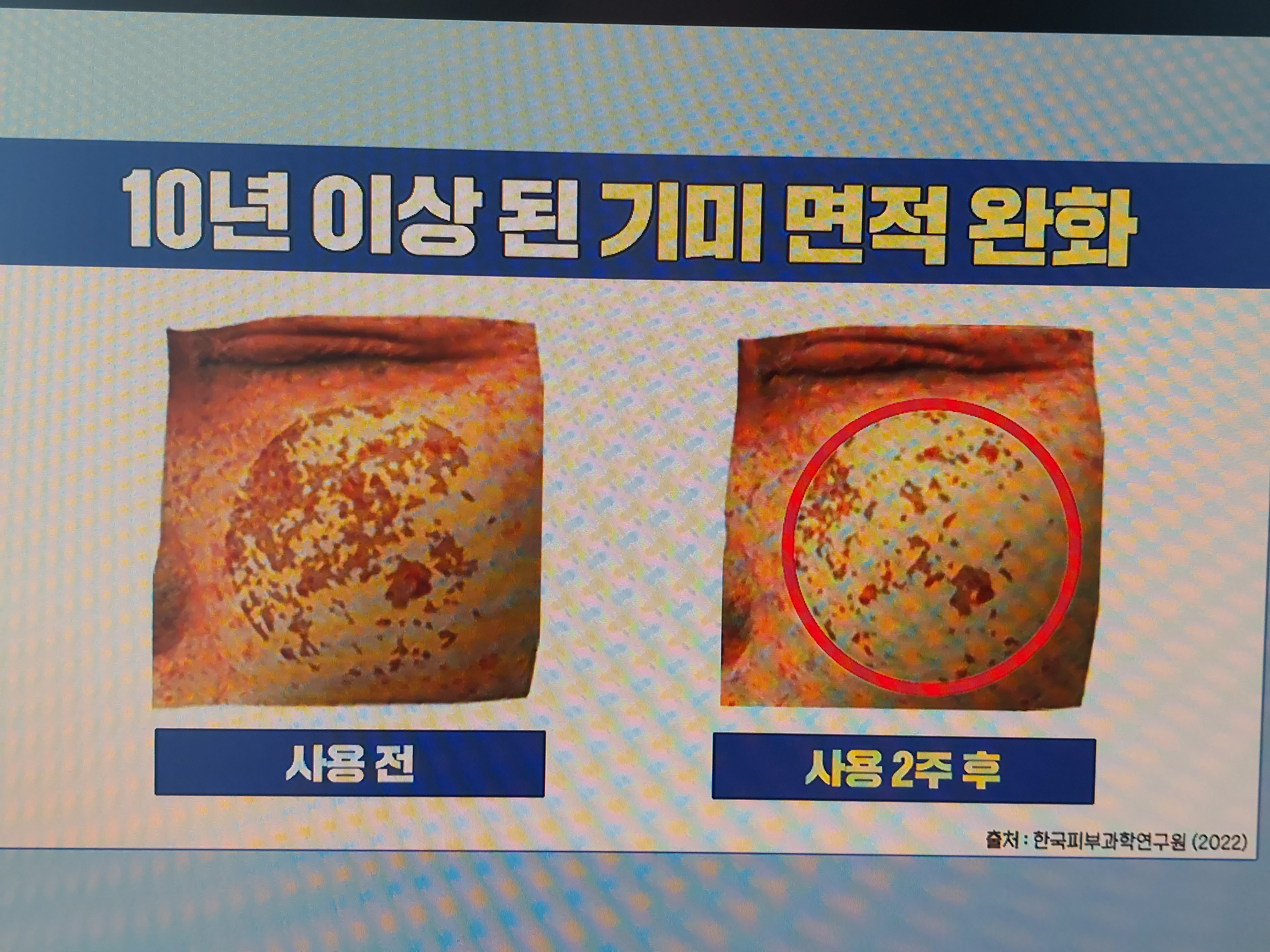 화이트 매스틱 효능