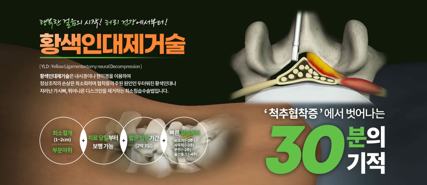  강남정형외과, 척추 어깨 무릎 치료 잘하는 병원 찾으신다면