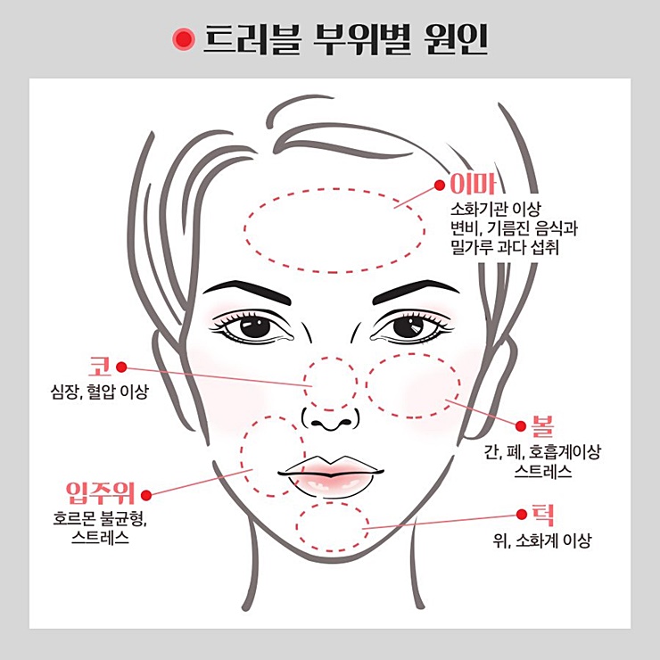 여드름 부위별 원인과 치료법 8