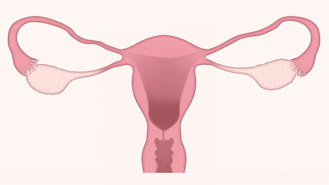 다낭성 난소 증후군 증상 원인 치료 쉽게 정리