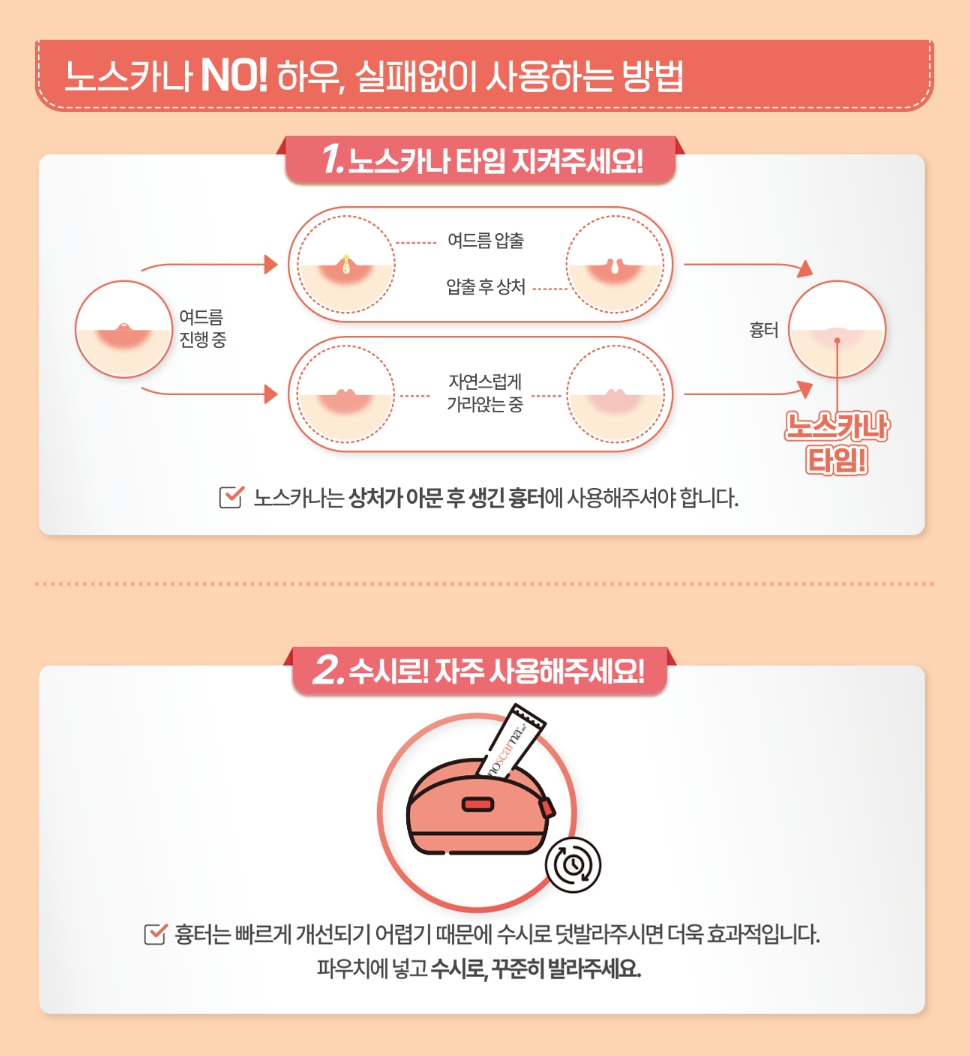 노스카나겔 사용하는 방버