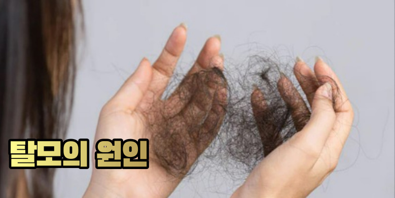 탈모의 원인