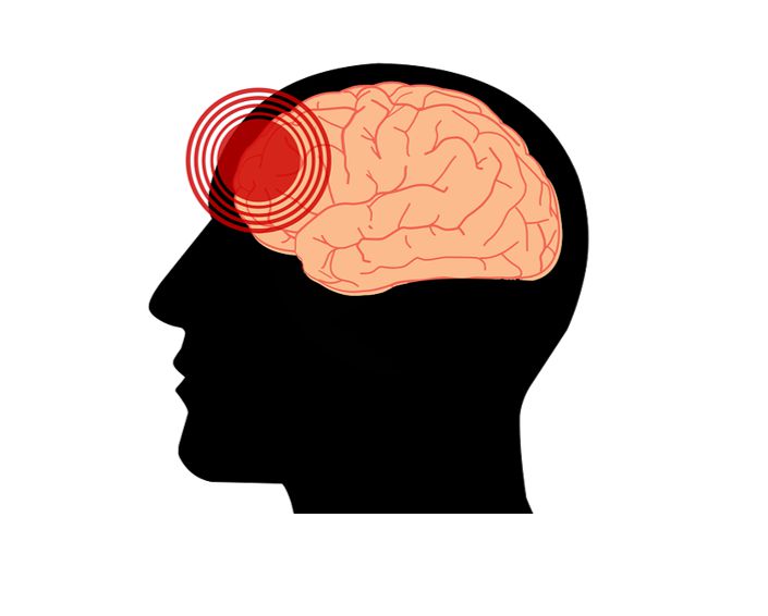 뇌의 통증 그래픽