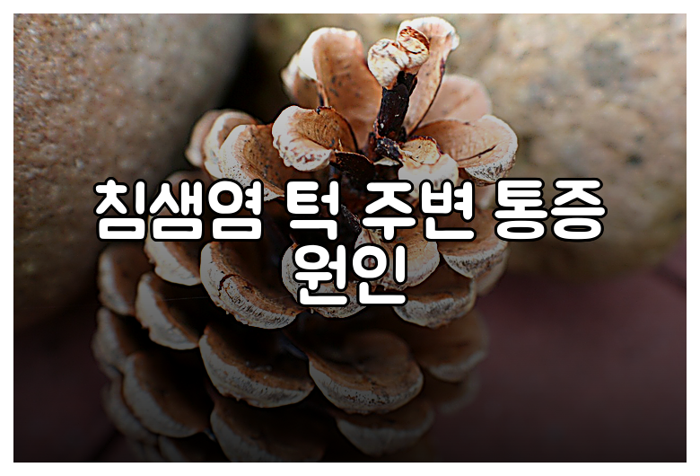 침샘염 턱 주변 통증 원인