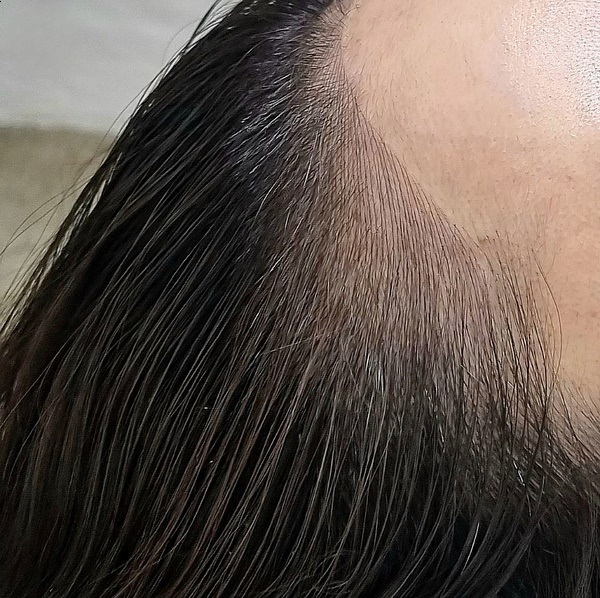  광주헤어라인문신 대박 이마라인 무슨 일이야?