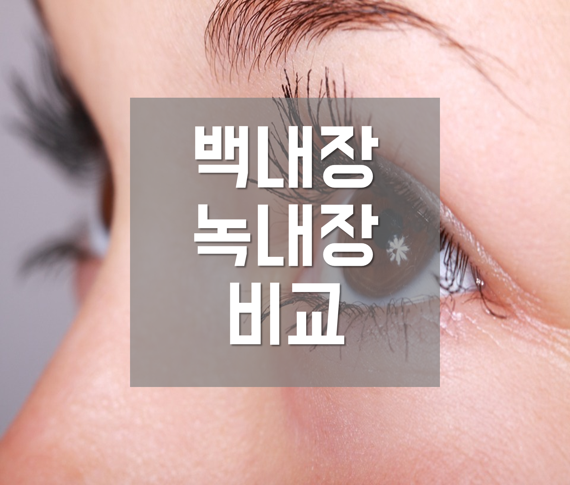  백내장 녹내장 차이 비교 (이름 유래, 원인, 증상, 치료)