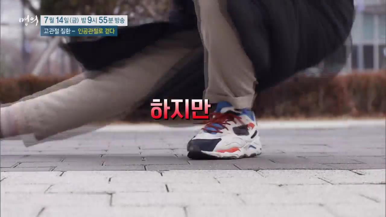 EBS 826회 명의 고관절 질환 - 인공관절로 걷다, 수술 후 합병증, 부작용 및 생활 관리, 퇴행성 관절염, 골절, 대퇴골두무혈성 괴사 치료 방법 강북 삼성병원 박윤수 박재형 교수