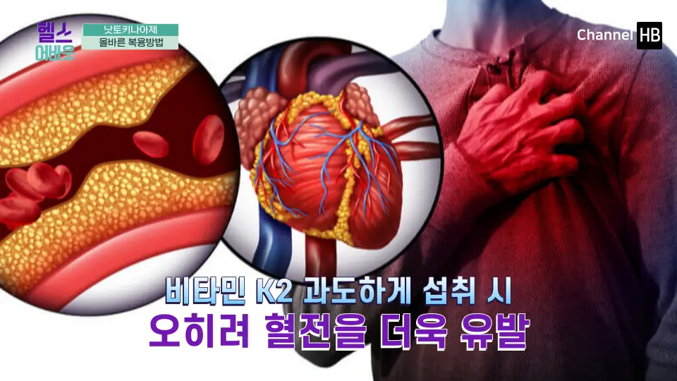 혈전용해제 나토키나제