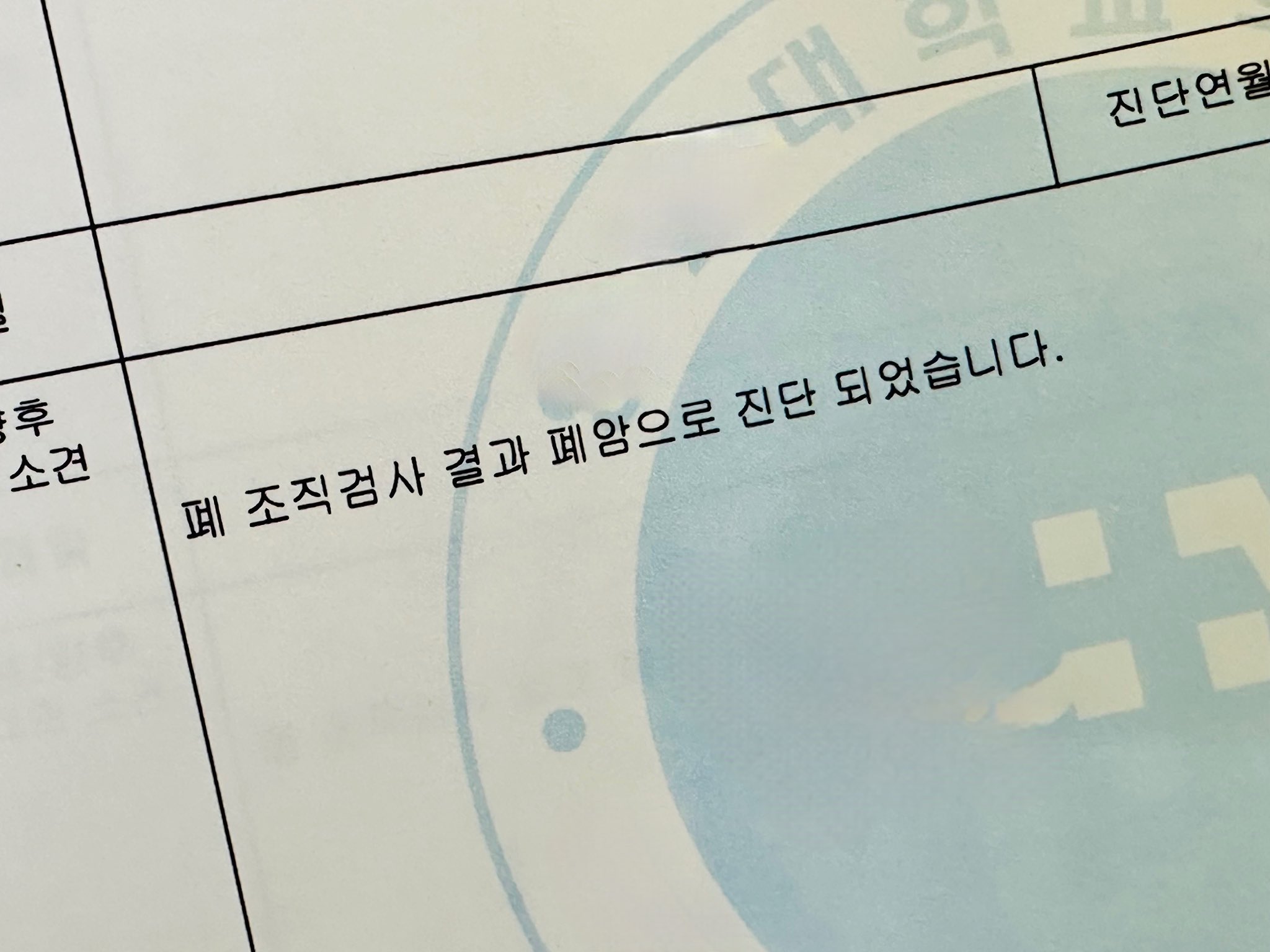폐암
