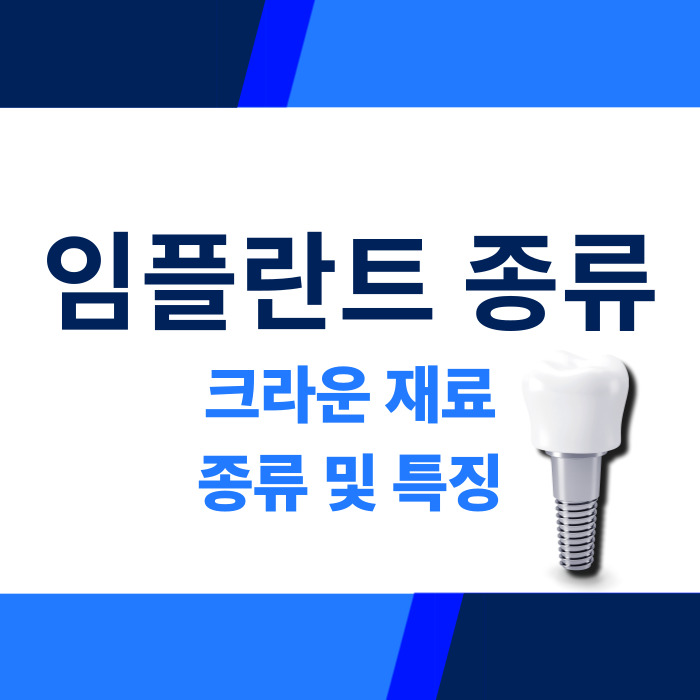 임플란트 종류