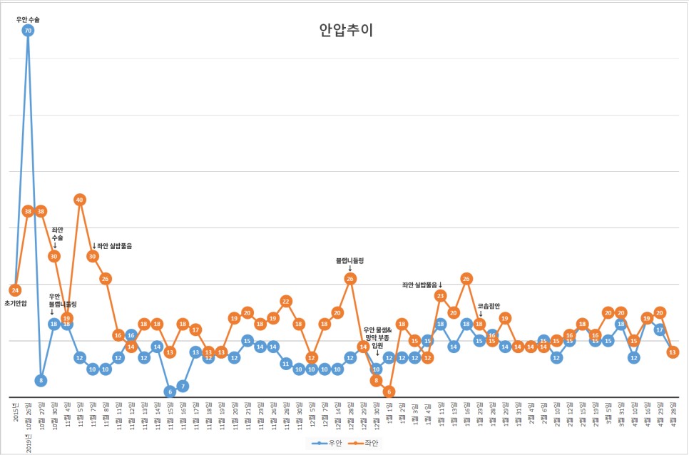 - 2020년 4월 29일 폐쇄각녹내장대학병원 진료 리뷰