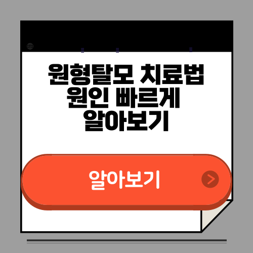 원형탈모 치료법