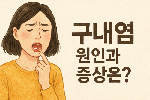 잦은-구내염-원인-낫는-걸리는-기간