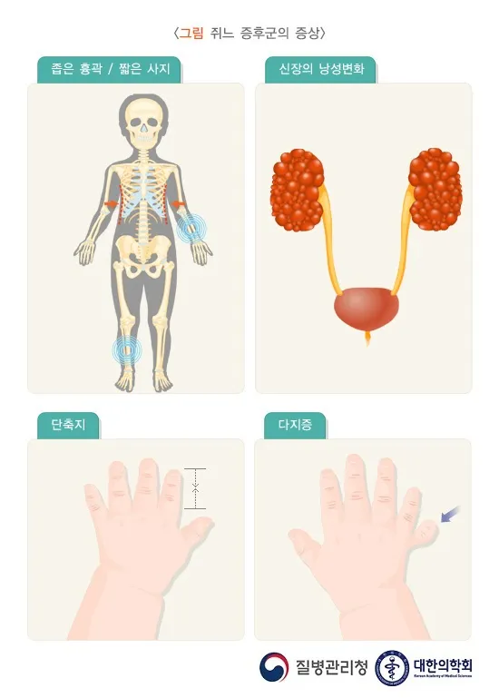 바테르증후군 원인 증상 치료법_8