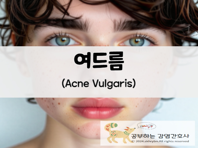 피부 질환_청소년 여드름(acne vulgaris) 원인, 흉터, 약, 치료, 관리