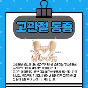 고관절 통증 증상 확인하기_7