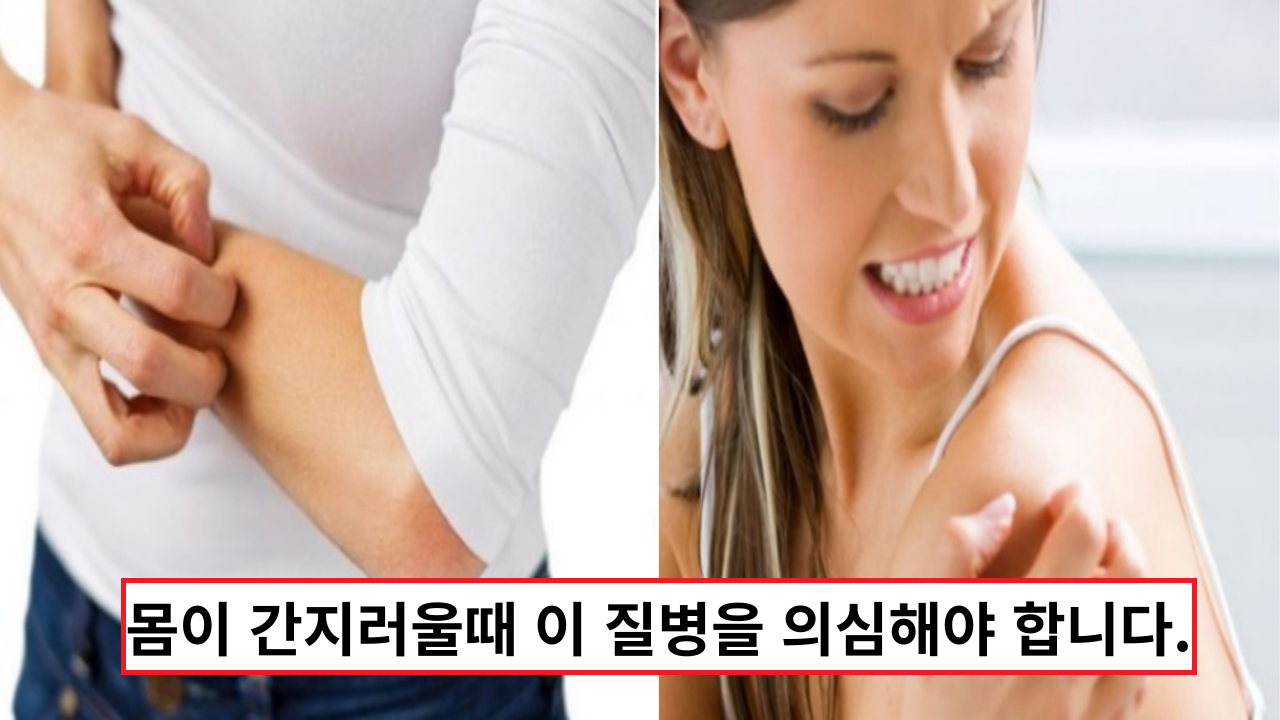  '몸이 갑자기 간지러워요' 그냥 지나치지 말고 이 질병을 의심해야 합니다.