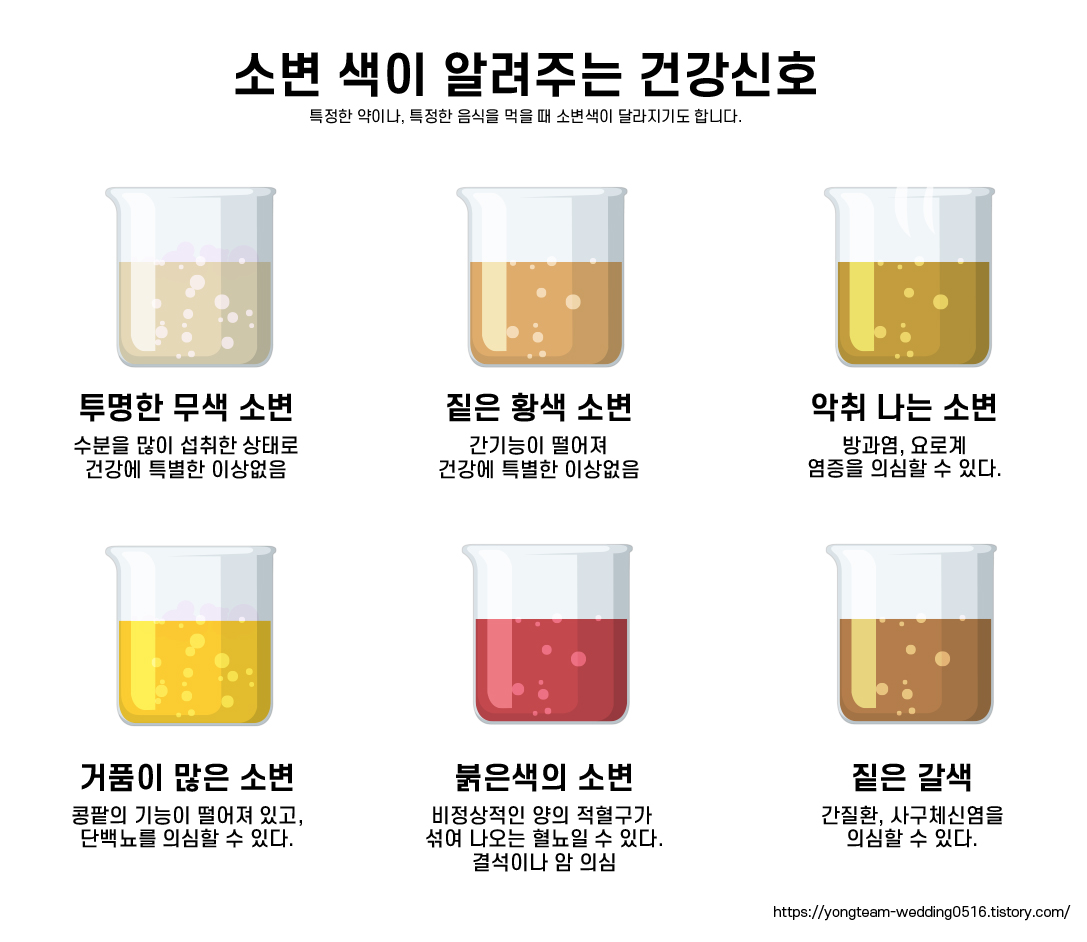  소변 색이 알려주는 건강신호