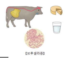  브루셀라병? 브루셀라증 중국 집단감염 이어져