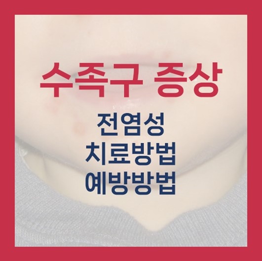 수족구 증상