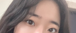  3년 뒤 쓰는 쌍수 매몰 눈매교정 내돈내산 자연유착 후기 (수술 당일부터 붓기, 기간별 변화, 현재모습)
