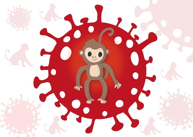 엠폭스 원숭이 두창 전염 감염