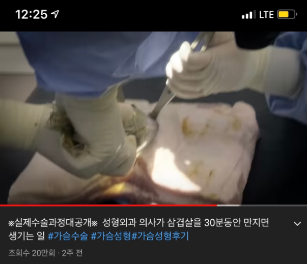  네이트판 레전드 - 여자친구 가슴수술 동의해줘야 하나요?