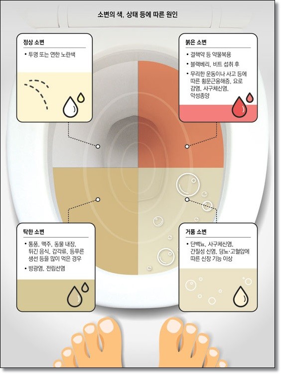 소변의색