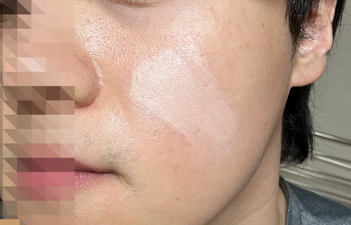 클리오-킬커버-파운웨어-오리지널-오른쪽뺨-바른모습