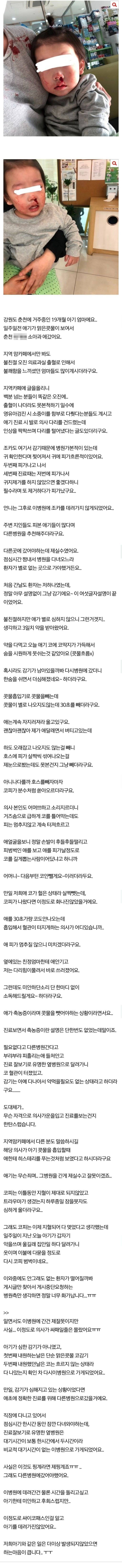  강원도 춘천의 한 소아과에서 아기 출혈 논란