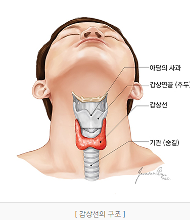 갑상선 암 치료