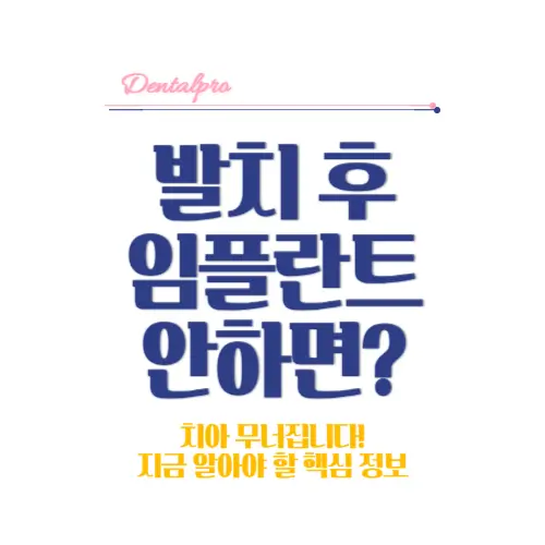 발치후 임플란트 안하면