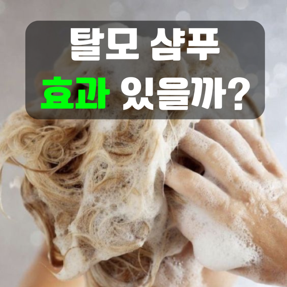  탈모 샴푸 효과 있을까요? 탈모치료 정수리탈모