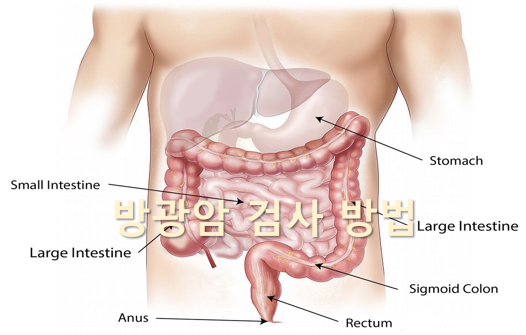  방광암을 진단하는 방광암 검사 방법
