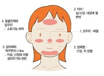  이마에만 여드름이 나는 원인과 대처방안 !!