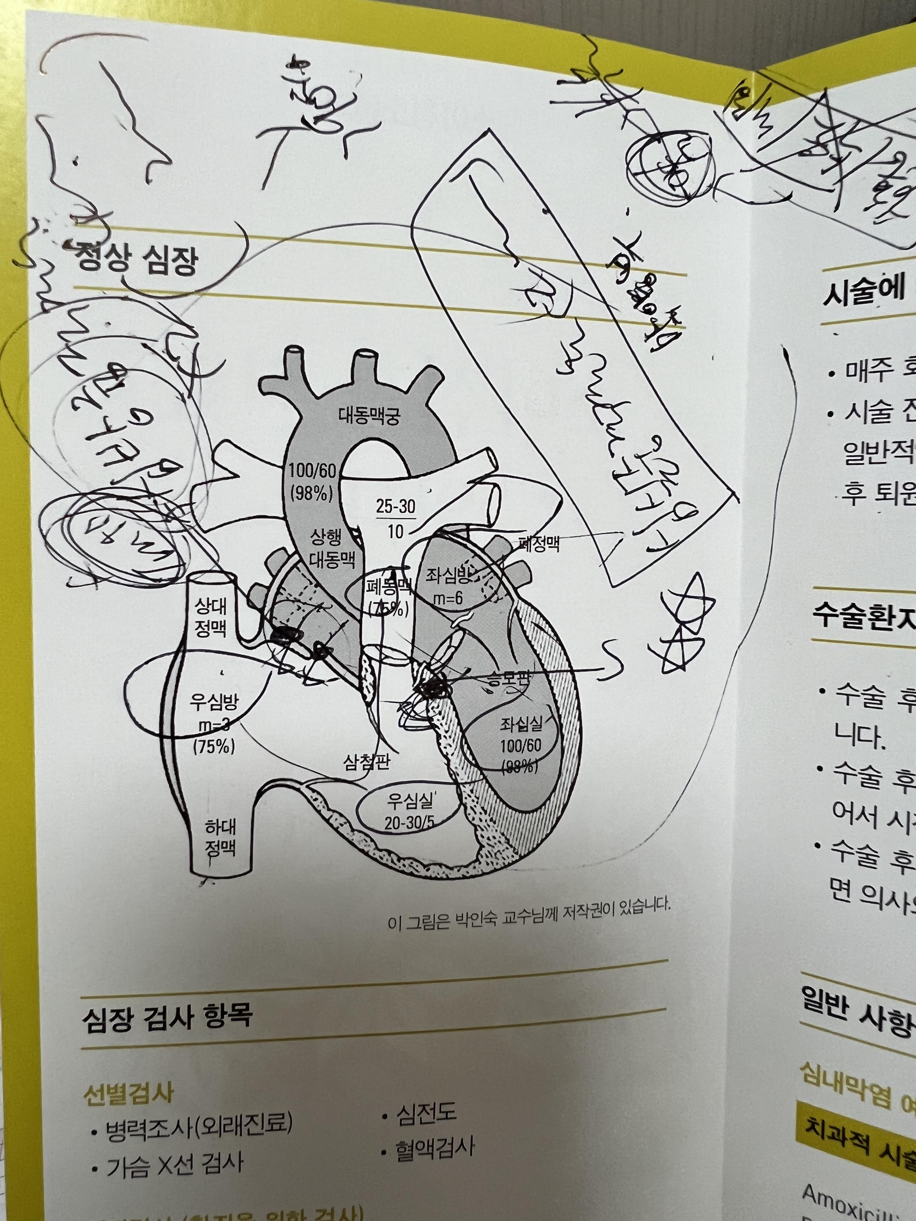  딤플 척수 검사 이상無, 심실/심방중격결손 판정