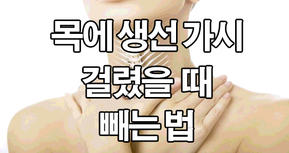  목에 가시 걸렸을때 빼는법 : 생선가시