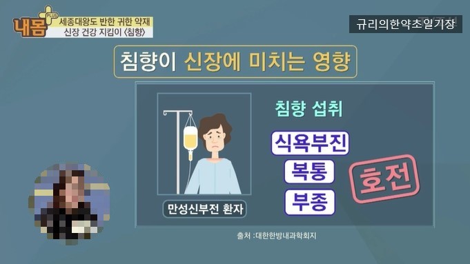침향환 관련 사진