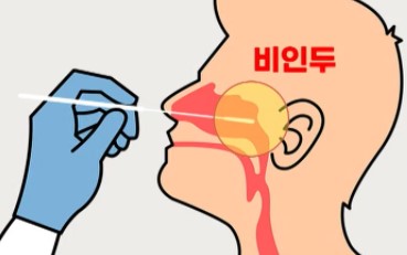신속항원검사