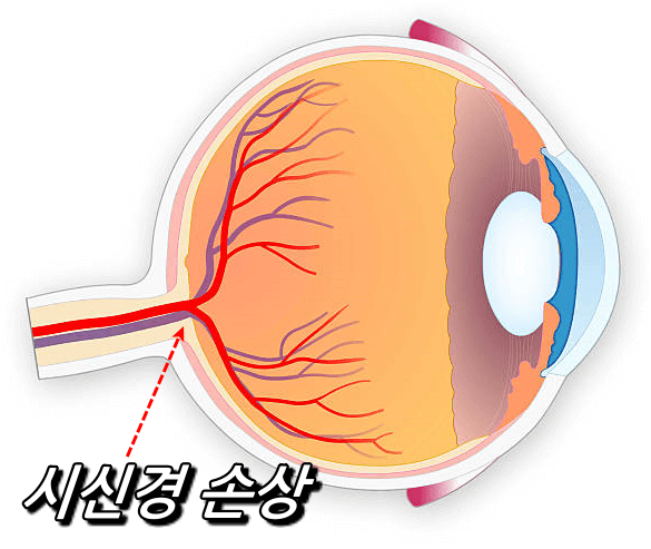 안구-시신경